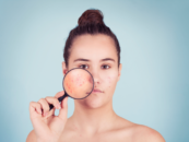 Łysienie telogenowe – najważniejsze objawy